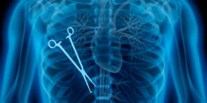 Surgical Errors